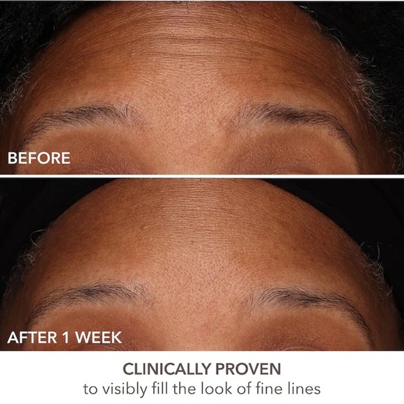 🆕 DR DENNIS GROSS Skincare 15 mL DermInfusions™ Fill + Repair Serum NWOB - Picture 4 of 10